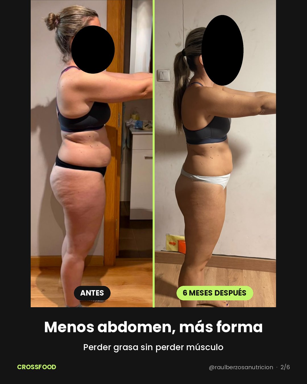 Antes y 6 meses después de perfil: menos abdomen, más forma